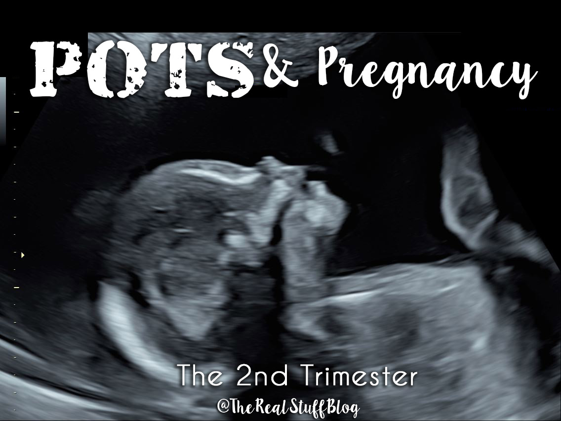 POTS & Pregnancy: 2nd Trimester - The Real Stuff Blog